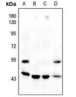 JNK1/2/3 (Phospho-T183/Y185) Rabbit Polyclonal Antibody