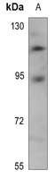 TRAP100 Rabbit Polyclonal Antibody