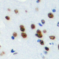 TRAP100 Rabbit Polyclonal Antibody