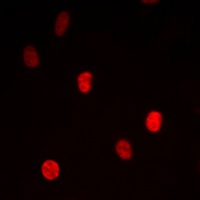TRAP100 Rabbit Polyclonal Antibody