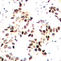 MEF2A (Phospho-T312) Rabbit Polyclonal Antibody