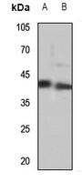 MEIS1 Rabbit Polyclonal Antibody