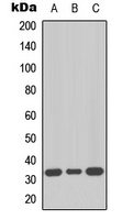 MKI67IP Rabbit Polyclonal Antibody