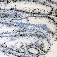 MKI67IP Rabbit Polyclonal Antibody