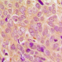 Ezrin/Radixin/Moesin (Phospho-T567/564/558) Rabbit Polyclonal Antibody