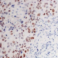 c-Myc Rabbit Polyclonal Antibody
