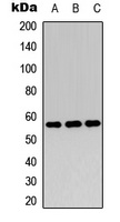 c-Myc (Phospho-T358) Rabbit Polyclonal Antibody