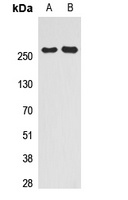 SMRT Rabbit Polyclonal Antibody