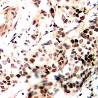 SMRT Rabbit Polyclonal Antibody