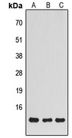 NDUFS5 Rabbit Polyclonal Antibody