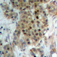 NEK9 (Phospho-T210) Rabbit Polyclonal Antibody