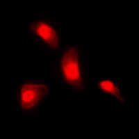 NFAT3 Rabbit Polyclonal Antibody