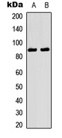 TRK A (Phospho-Y496) Rabbit Polyclonal Antibody