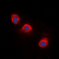 TRK A (Phospho-Y496) Rabbit Polyclonal Antibody