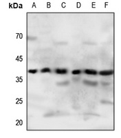P2Y4 Rabbit Polyclonal Antibody