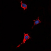 P2Y4 Rabbit Polyclonal Antibody