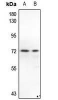 PAK1/2/3 Rabbit Polyclonal Antibody