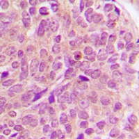 PAK1/2/3 Rabbit Polyclonal Antibody