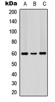 PDCD4 (Phospho-S67) Rabbit Polyclonal Antibody