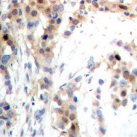 PDCD4 (Phospho-S67) Rabbit Polyclonal Antibody