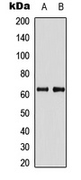 PDPK1 Rabbit Polyclonal Antibody