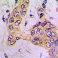 PDPK1 Rabbit Polyclonal Antibody