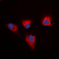 PEA15 Rabbit Polyclonal Antibody