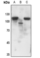 Progesterone Receptor (Phospho-S190) Rabbit Polyclonal Antibody