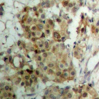 Progesterone Receptor (Phospho-S190) Rabbit Polyclonal Antibody