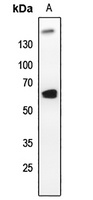 PLK1 Rabbit Polyclonal Antibody