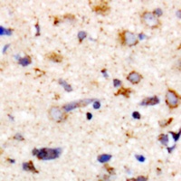 MYPT1 (Phospho-T853) Rabbit Polyclonal Antibody
