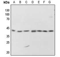 PKA C alpha/beta/gamma (Phospho-T198) Antibody