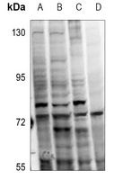 PKC alpha (Phospho-T638) Rabbit Polyclonal Antibody