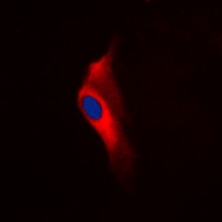 PKC epsilon (Phospho-S729) Rabbit Polyclonal Antibody