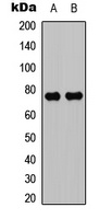 PKC theta Rabbit Polyclonal Antibody