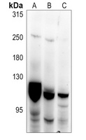PKC mu Rabbit Polyclonal Antibody