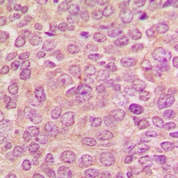 PKC mu Rabbit Polyclonal Antibody