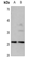 CD201 Rabbit Polyclonal Antibody