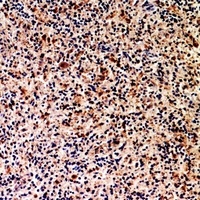 CD201 Rabbit Polyclonal Antibody