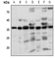 PGD2 Receptor Rabbit Polyclonal Antibody