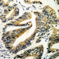 Paxillin Rabbit Polyclonal Antibody