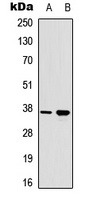 RAD51A (Phospho-Y315) Rabbit Polyclonal Antibody