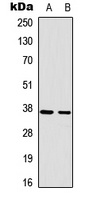 RAD51A Rabbit Polyclonal Antibody