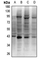 RAD51D Rabbit Polyclonal Antibody
