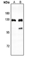 CTIP Rabbit Polyclonal Antibody