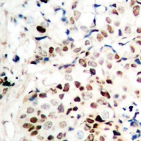 CTIP Rabbit Polyclonal Antibody