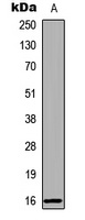 RBP5 Rabbit Polyclonal Antibody