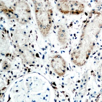 RBP5 Rabbit Polyclonal Antibody