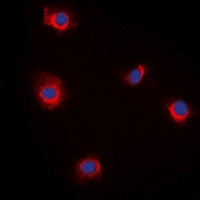 RBP5 Rabbit Polyclonal Antibody