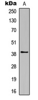 Rhodopsin Rabbit Polyclonal Antibody